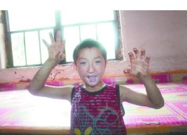 9岁男孩不知疼滋味 咬破手指无痛感(图)