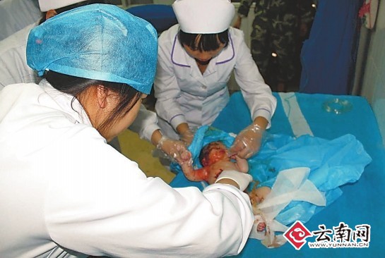  男婴被弃 粪坑内 众人救助仍夭折_云南网