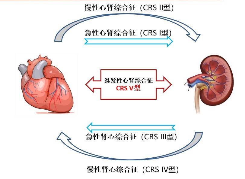 上海市胸科医院何奔教授团队在国际上首次提出心肾综合征第六种亚型