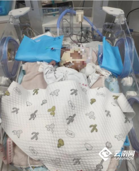 出生10天却患有复杂先心病 云南省阜外医院为这名患儿赢得生的希望